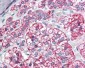 MCAD / ACADM Antibody (C-Terminus)